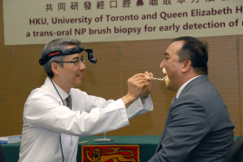 多倫多大學醫學院耳鼻喉頭頸外科學系副教授吳憲威醫生示範如何經口腔通往鼻咽抽取樣本。此方法由香港大學、多倫多大學及伊利沙伯醫院共同研發。
